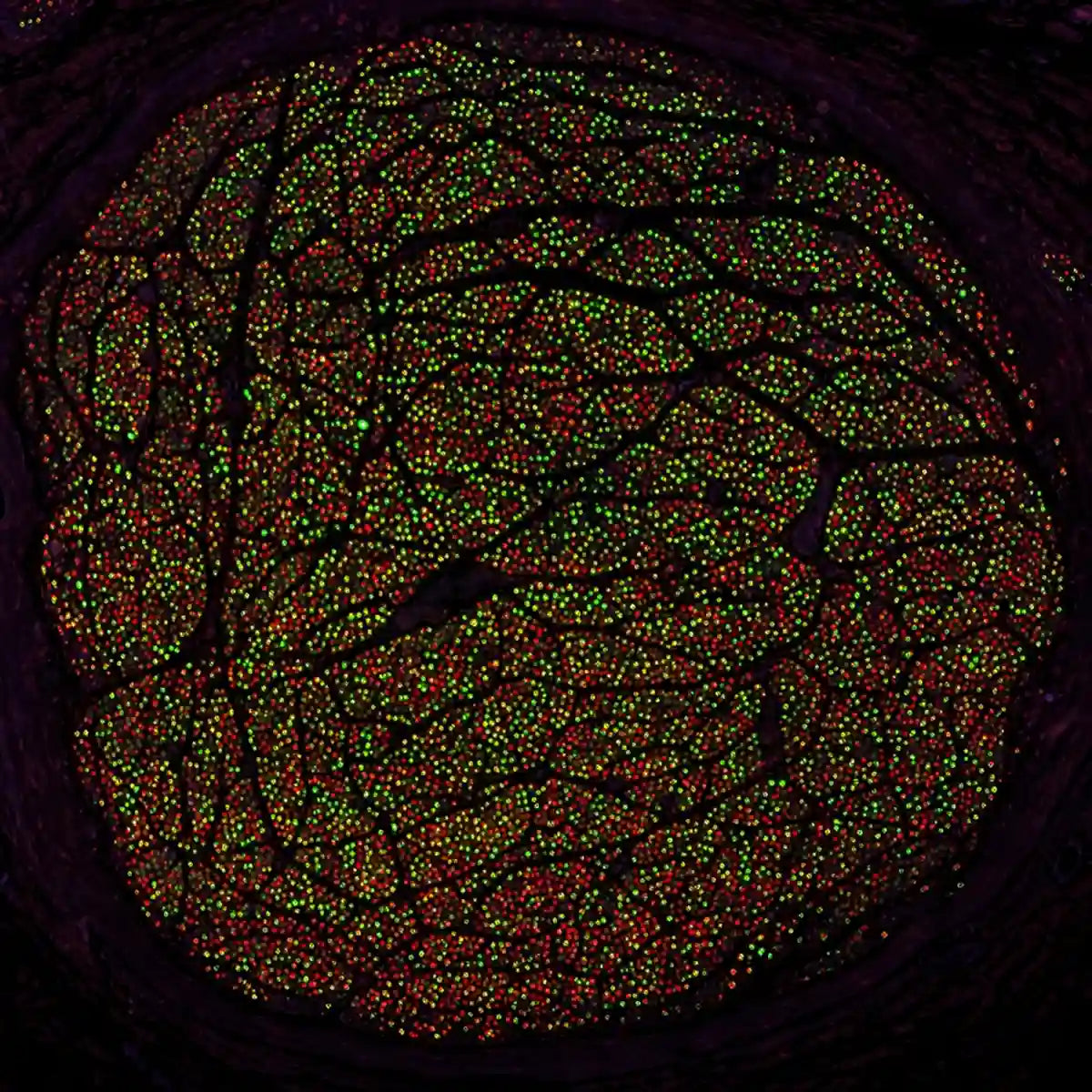 World's First Comprehensive Human Vagus Nerve Atlas: New Coordinates for Precision Neuromodulation
