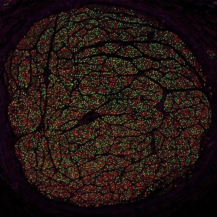 World's First Comprehensive Human Vagus Nerve Atlas: New Coordinates for Precision Neuromodulation